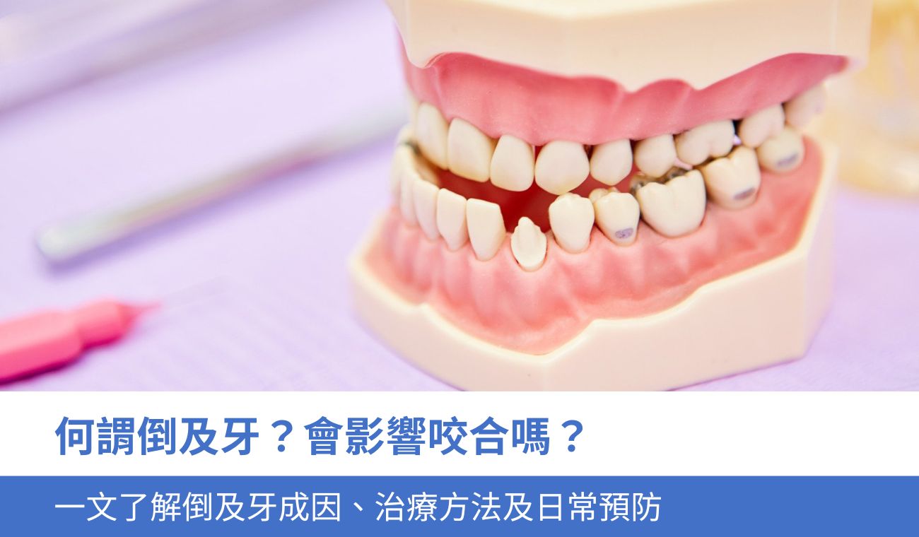 何謂倒及牙？