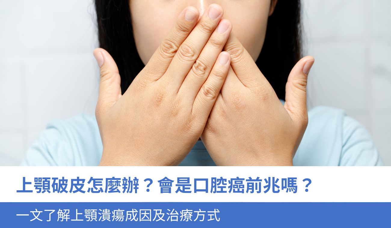 上顎破皮怎麼辦？口腔癌前兆？3分鐘了解上顎發炎、潰瘍原因及治療方式
