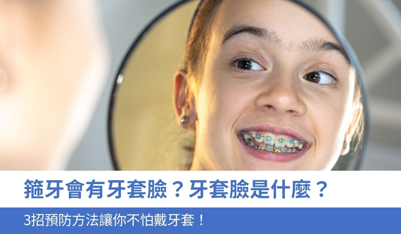 牙套臉是什麼？箍牙會有牙套臉？醫生分享3招預防戴牙套造成臉部凹陷的方法