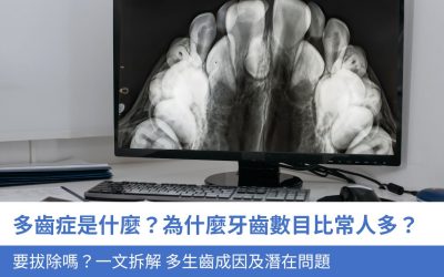 多齒症是什麼？為什麼牙齒數目比常人多？要拔除嗎？一文拆解多生齒成因及4大潛在問題