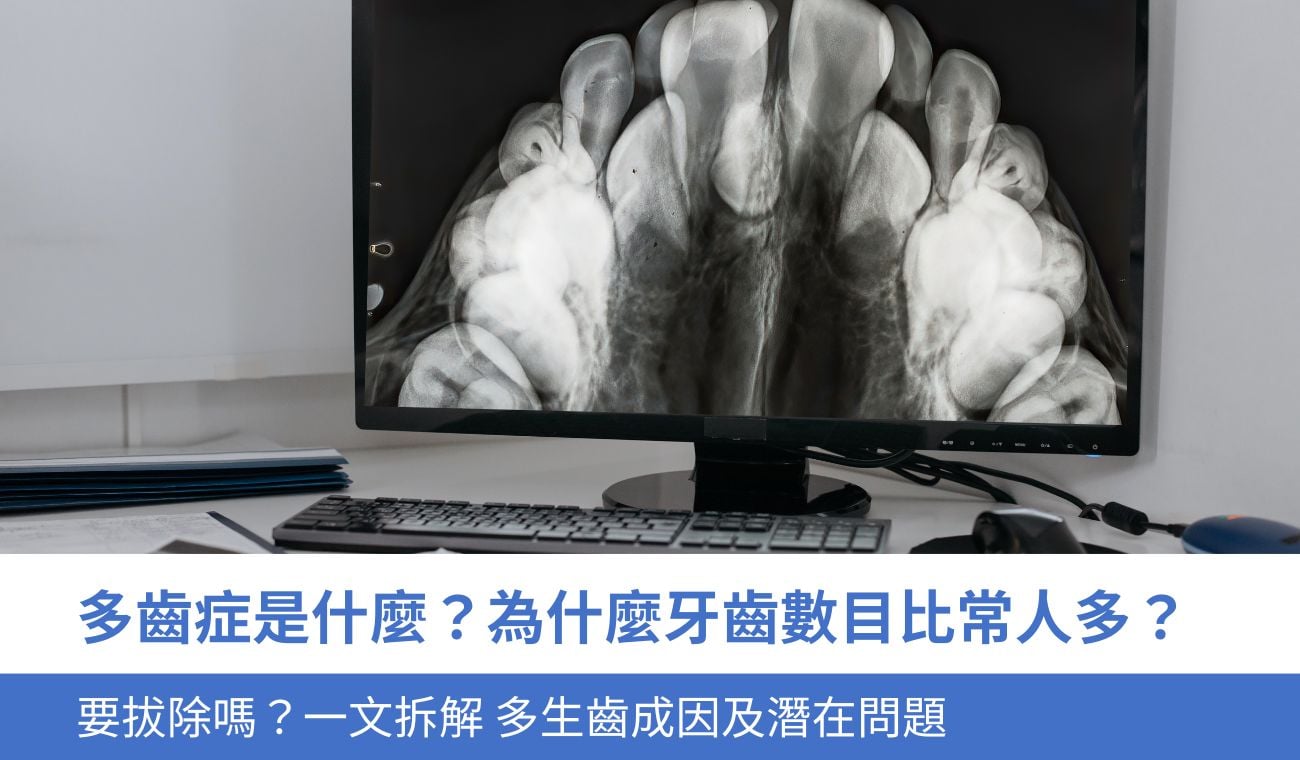 多齒症是什麼？