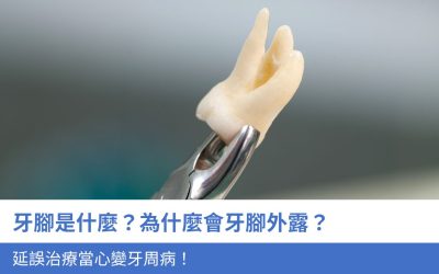 牙腳是什麼？為什麼會牙腳外露？延誤治療當心變牙周病！4招教你有效預防