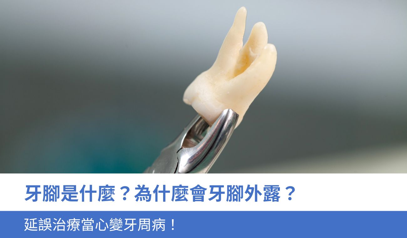 牙腳是什麼?為什麼會牙腳外露?