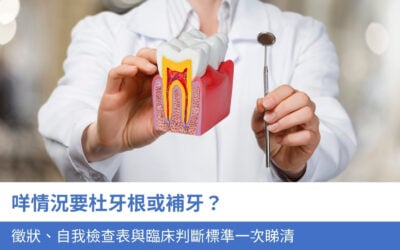 咩情況要杜牙根或補牙?4大徵狀、自我檢查表與臨床判斷標準一次睇清