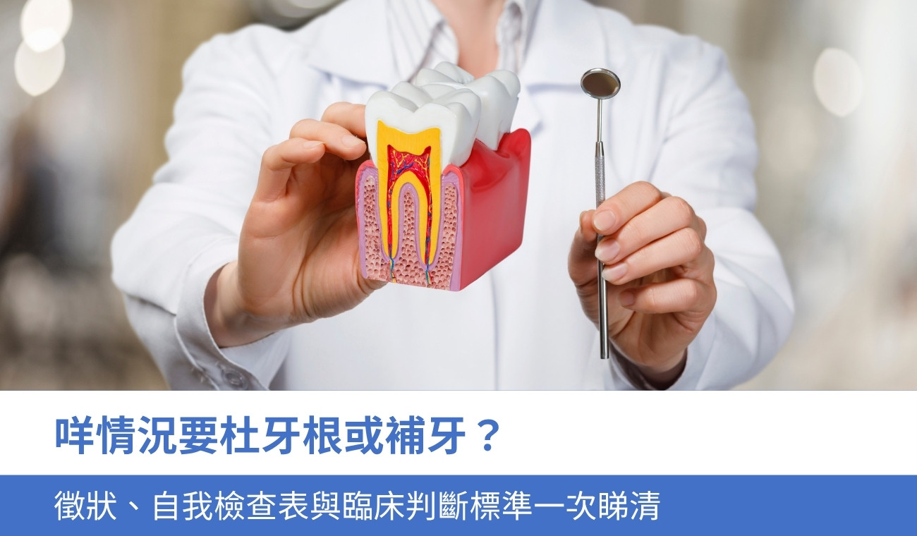 what-situation-needs-to-root-canal 咩情況要杜牙根或補牙?4大徵狀、自我檢查表與臨床判斷標準