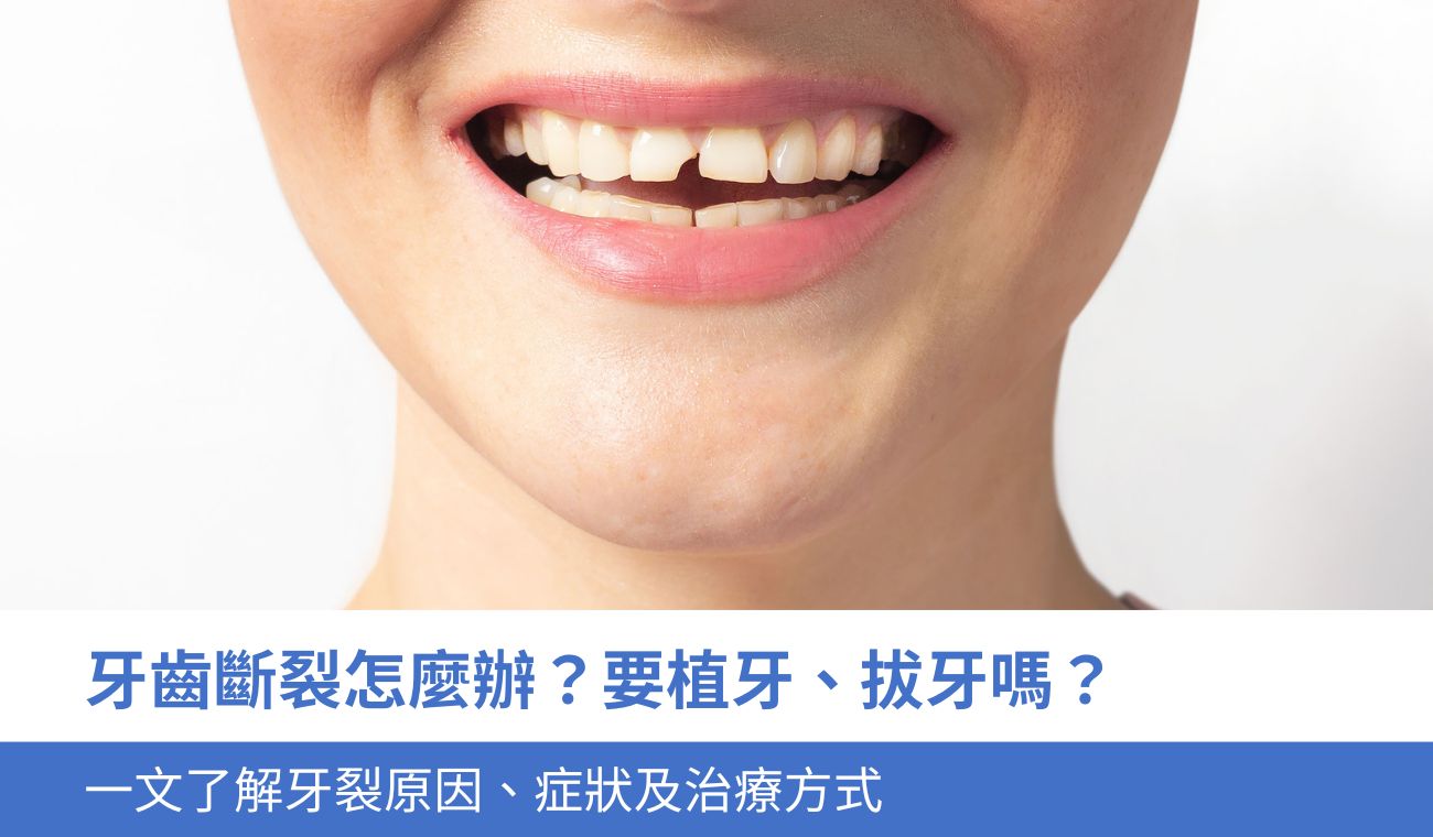 牙齒斷裂怎麼辦？