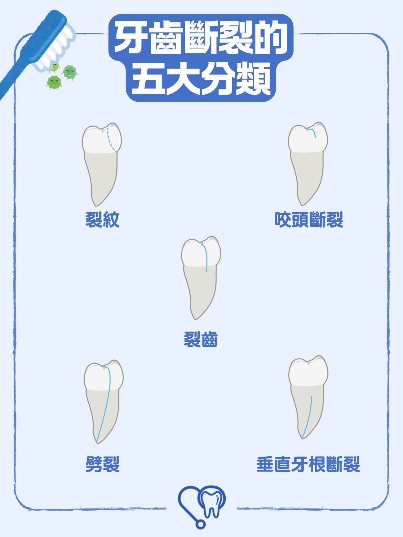 牙齒斷裂的五大分類