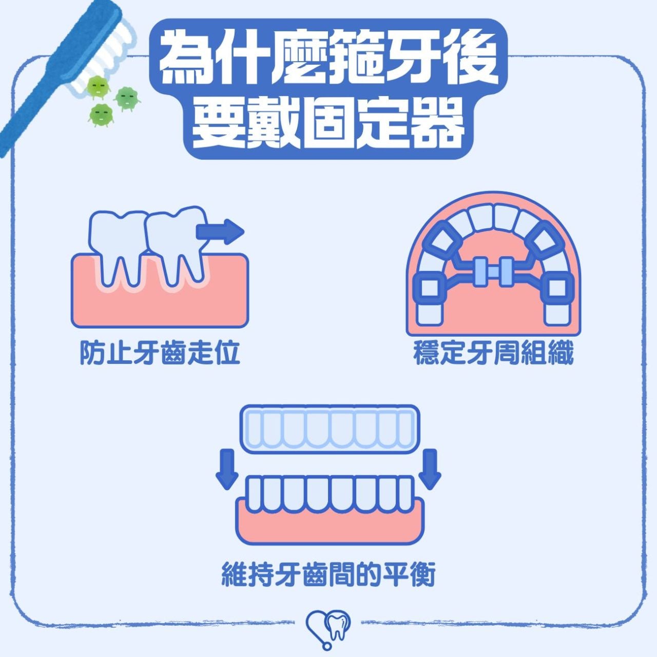 為什麼箍牙後牙齒要佩戴 固定器？3大矯正牙齒固定器 Retainer 種類及價錢話你知
