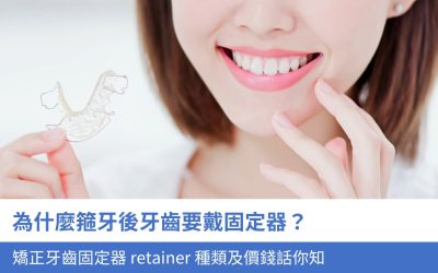 為什麼箍牙後牙齒要佩戴 固定器？3大矯正牙齒固定器 Retainer 種類及價錢話你知