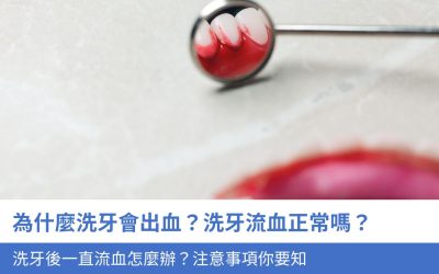 為什麼洗牙會出血？洗牙流血正常嗎？洗牙後一直流血怎麼辦？3大注意事項你要知