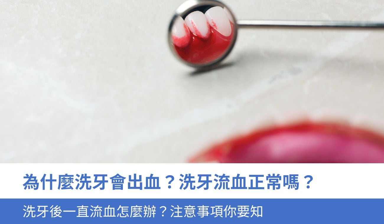 為什麼洗牙會出血？