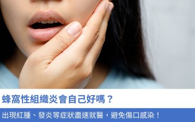 蜂窩性組織炎會自己好嗎？出現紅腫、發炎等4大 症狀盡速就醫，避免傷口感染！
