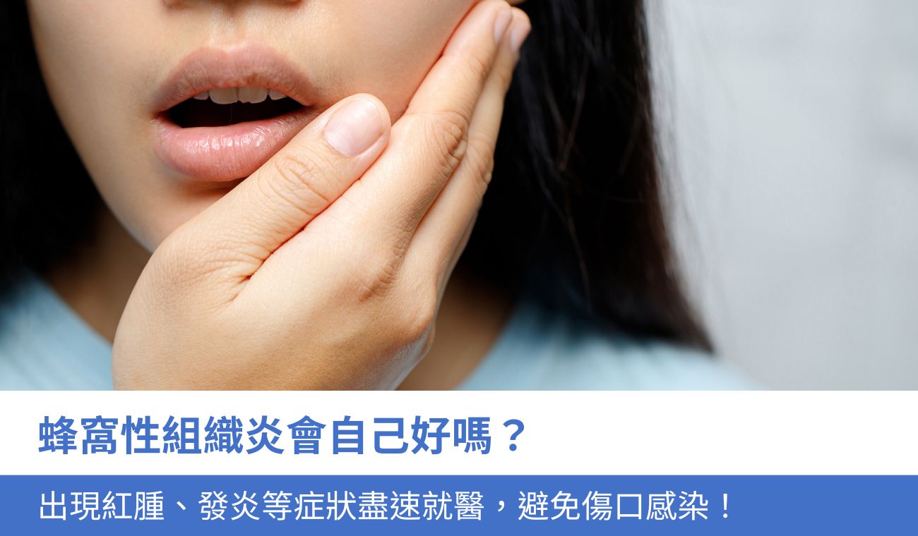 蜂窩性組織炎會自己好嗎？出現紅腫、發炎等症狀盡速就醫，避免傷口感染！