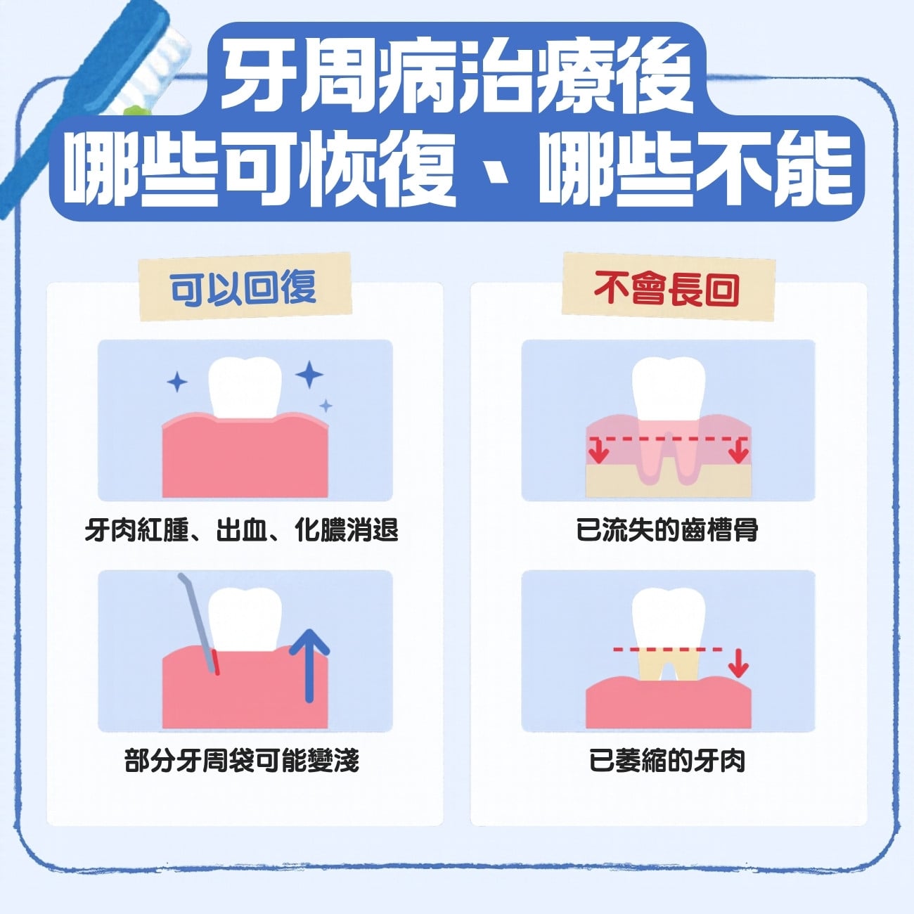 牙周病治療後,哪些可以恢復、哪些不能?
