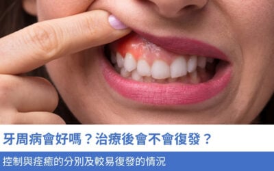 牙周病會好嗎?治療後會不會復發?控制與痊癒的分別及 4 類較易復發的情況