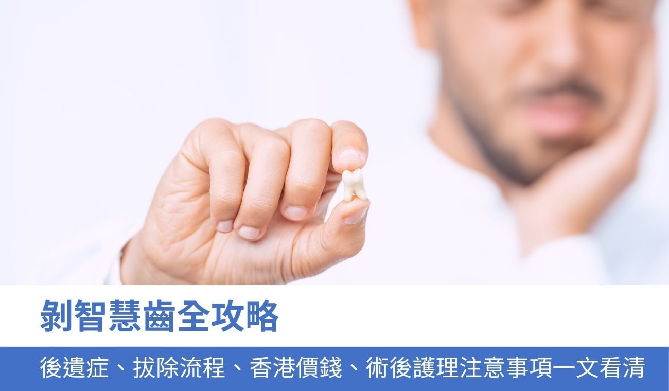剝智慧齒全攻略：拔牙後遺症、收費、流程、術後護理注意事項一文看清