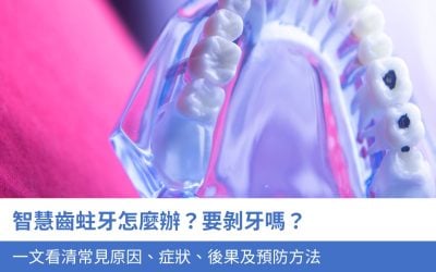 智慧齒蛀牙怎麼辦？要剝牙嗎？一文看清常見原因、症狀、後果及預防方法