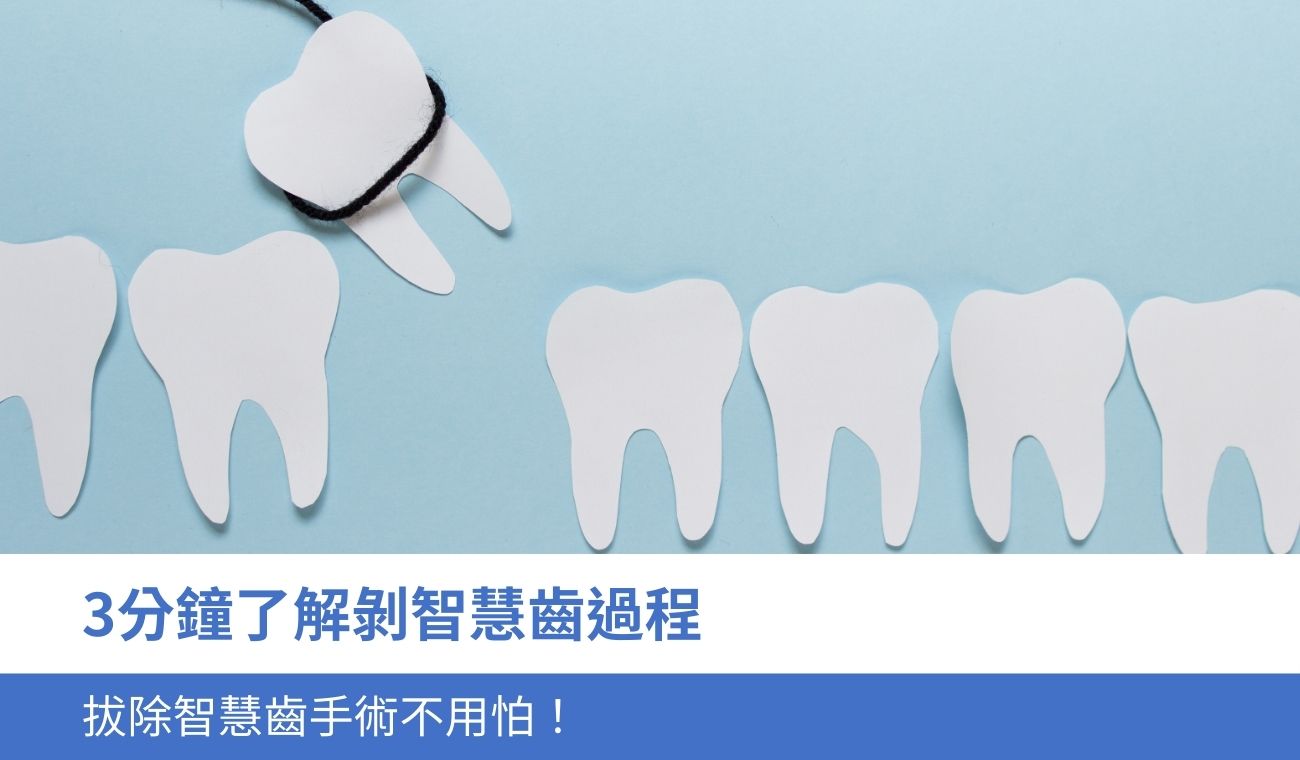 wisdom-tooth-extraction-process