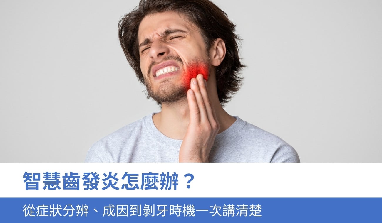 wisdom-tooth-inflammation 智慧齒發炎怎麼辦?從症狀分辨、成因到剝牙時機一次講清楚