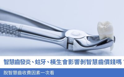智慧齒發炎、蛀牙、橫生 會影響剝智慧齒價錢嗎？4大 脫智慧齒收費因素一文看清